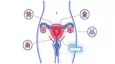 اضرار الجي سبوت او البقعة جي في المهبل كم تبعد وماهي مخاطر تحفيزها